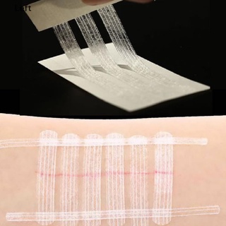 Steri-Strip trakice za zatvaranje kože (12mm x 100mm) - Pakovanje